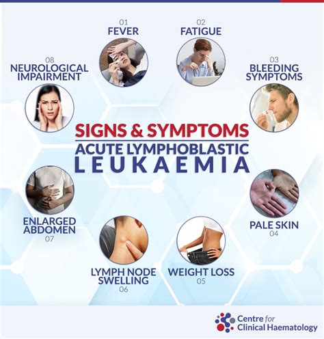 Acute Lymphoblastic Leukemia