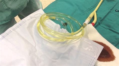 Urinary Catheter Procedure