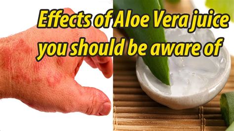 8 side effects of aloe vera juice you should be aware of - YouTube