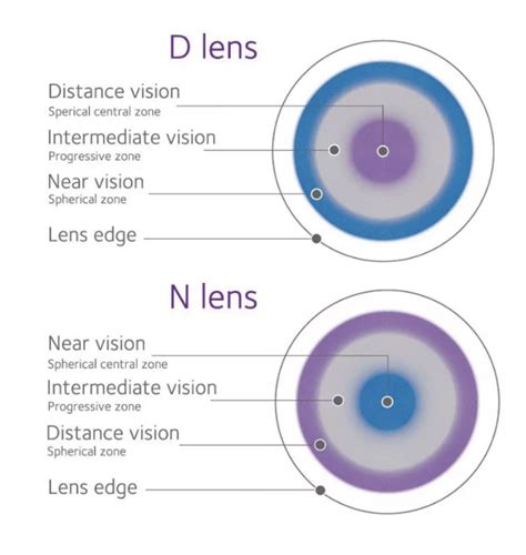 Multifocal Contact Lens Designs: Know the Players