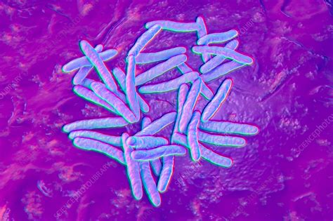 Tuberculosis bacteria, illustration - Stock Image - F037/5896 - Science ...