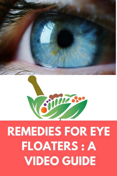 14 Remedies for Eye Floaters ideas | remedies, eyes, eye health