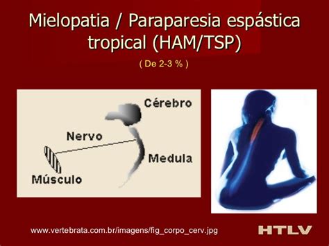 PARAPARESIA ESPASTICA TROPICAL PDF