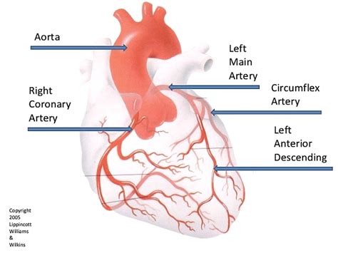 Coronary Angiography – Heartwest