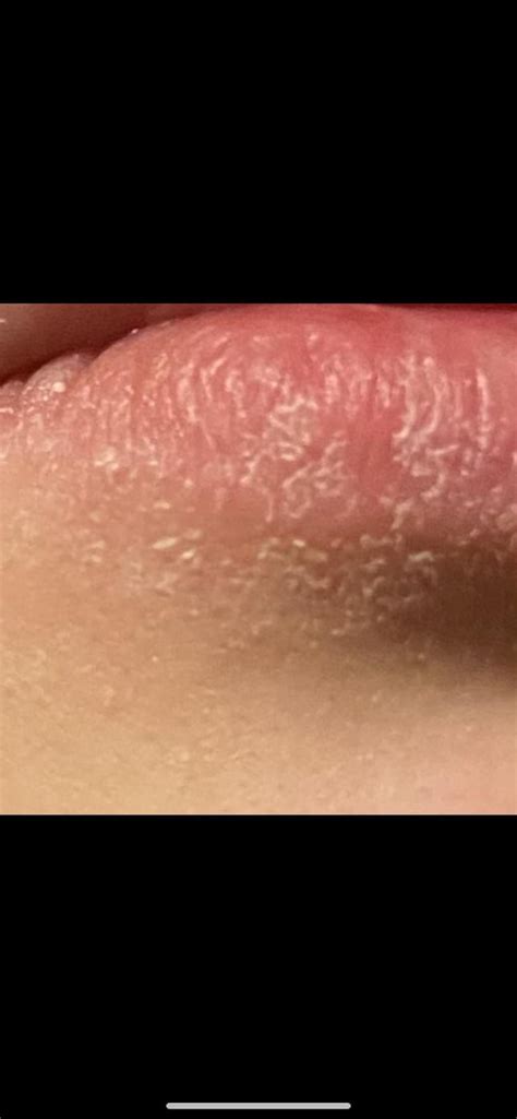 [Product Request] Dry patch on lip : r/SkincareAddiction