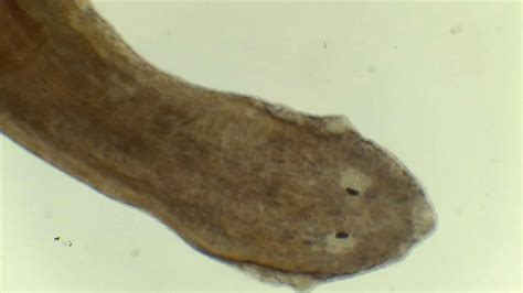 Planaria Under Microscope Labeled