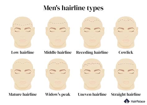 Hairline Types for Men and Women & How to Change Yours