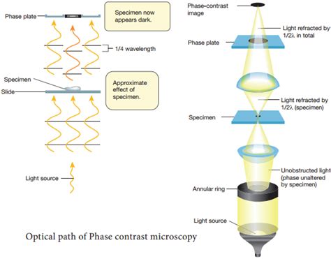 Phase Contrast Microscope – Definition, Principle, Parts, Uses – NCERT MCQ