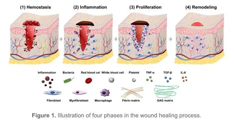 Healing Hacks: 4 Picture-Perfect Stages of Wound Healing | Credihealth