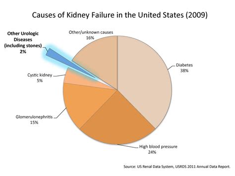 Cause of kidney failure in the