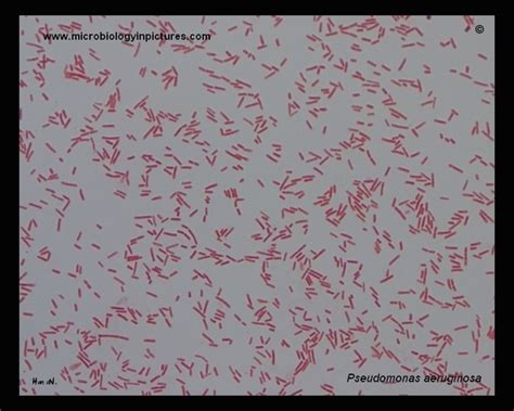 Pseudomonas Aeruginosa Gram Stain