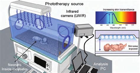 The imaging setup of neonatal infrared imaging under phototherapy ...