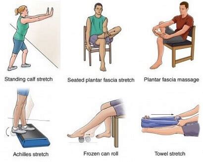 Plantar Fasciitis Exercises & Treatment - Foot Pain Explored