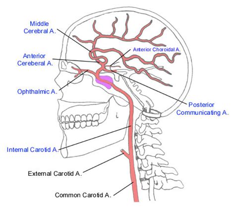 Internal Carotid Artery