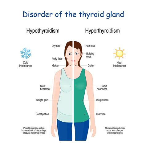 Thyroid Disorders : Overview, Causes, Symptoms, Treatment - illness.com