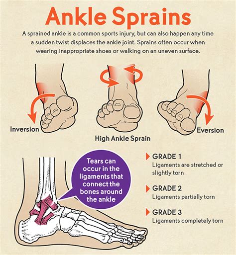 Common Injury for an Athlete – Ankle Sprain | Boulder County Foot & Ankle