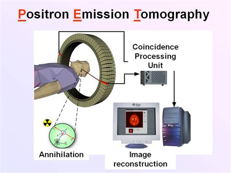 ektalks: Science in Medicine - Positron Emission Tomography (PET) with ...