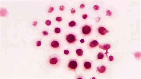 Cryptococcus Neoformans Gram Stain