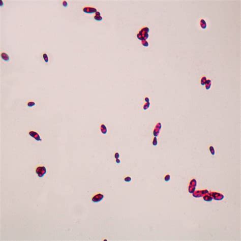 Candida albicans, w.m. Microscope Slide | Carolina Biological Supply