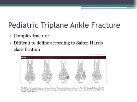 PPT - The Pediatric Triplane Ankle Fracture PowerPoint Presentation ...