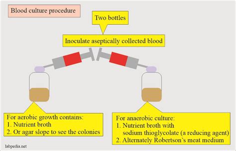 Blood Culture, its Procedure and Interpretations - Labpedia.net