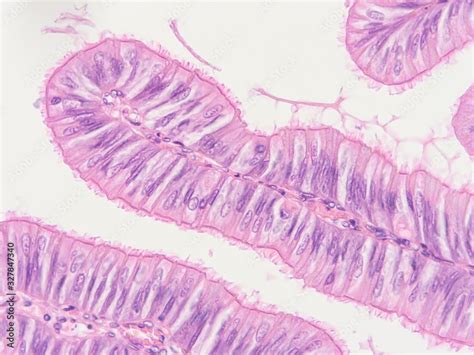 picture of histology human tissue with microscope from laboratory (not ...