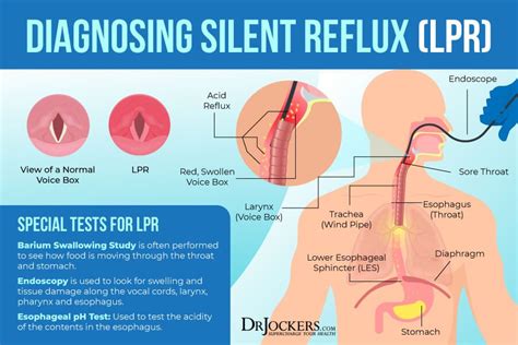 Silent reflux symptoms causes and support strategies – Artofit