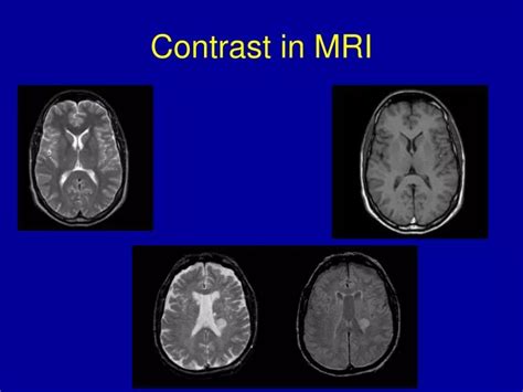 PPT - Contrast in MRI PowerPoint Presentation, free download - ID:6298927