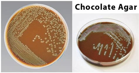 Chocolate Agar- Composition, Principle, Preparation, Results, Uses