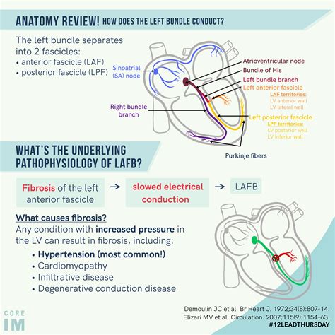 Left Anterior Fascicular Block | Core IM Podcast