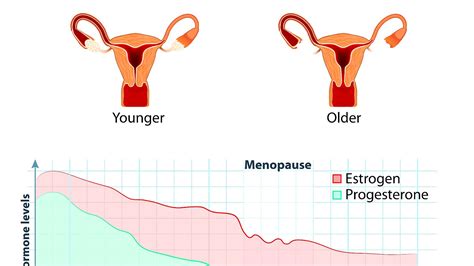 What Age Does Menopause Start And End - Menopause Choices