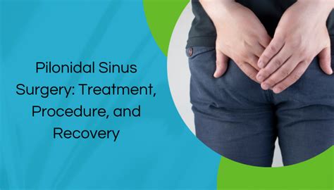 Pilonidal Sinus Surgery: Treatment, Procedure, And Recovery - Dr ...