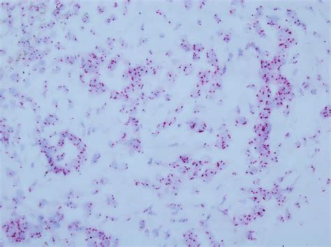 Enterobacter Aerogenes Gram Stain