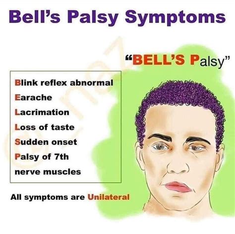 Pin by Brandie Garcia on Nursing | Bells palsy, Bell's palsy symptoms ...