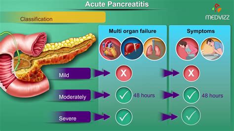 Pancreatic Diseases - Dr. Aniruddha Bhosale