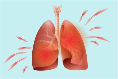 Arthritis in Lungs: How Rheumatoid Arthritis Affects Your Lungs