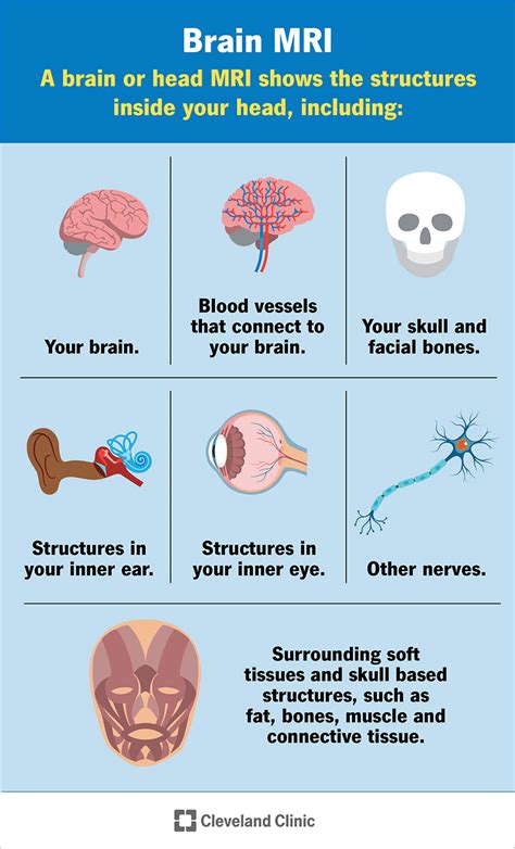 Brain MRI: What It Is, Purpose, Procedure & Results