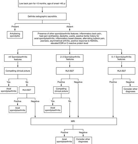 Spondyloarthropathy definition, types, causes, symptoms, diagnosis ...