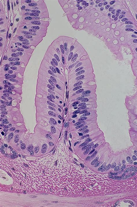 Simple Columnar Epithelium With Goblet Cells