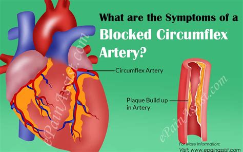 Femoral Artery Blockage Symptoms