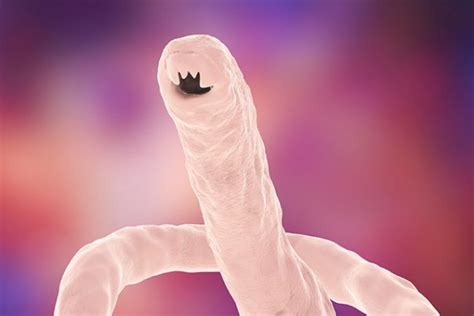 Hookworm infection – causes, side effects and treatments at ...