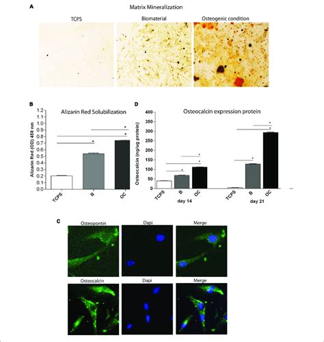 | Osteogenic markers in human bone marrow-derived mesenchymal stem ...