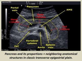 Presentation1.pptx, ultrasound study of the spleen and pancreas. | PPT