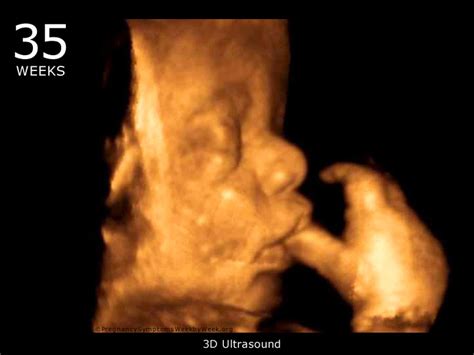 35 Week 3D Ultrasound Baby Picture | Pregnancy Symptoms Week by Week