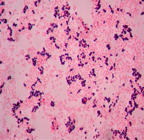 10: Gram Stain - Biology LibreTexts