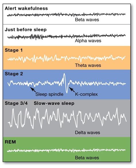 Brain Waves Diagram | Quizlet