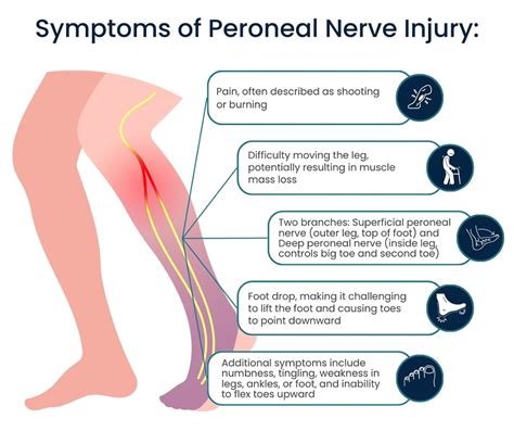 Peroneal Nerve Treatment in NYC | Pain Management NYC