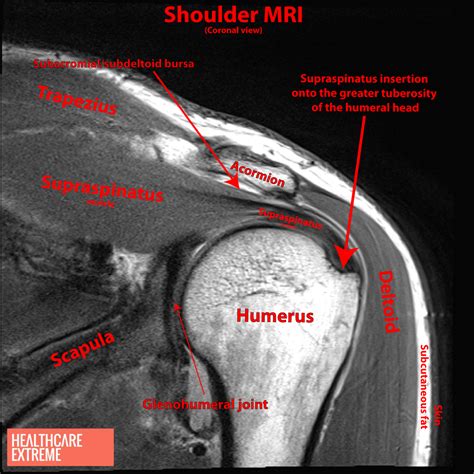 Shock And Suspense With Shoulder Subacromial Impingement Syndrome ...