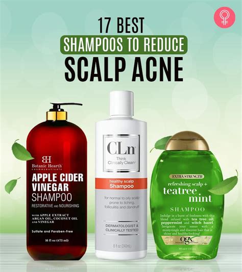 13 Best Scalp Acne Shampoos 2023 Head Breakout Treatments | lupon.gov.ph