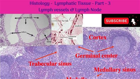 Tuberculosis Lymph Node Histology